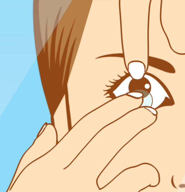 Sådan tager du dine kontaktlinser i, og ud igen